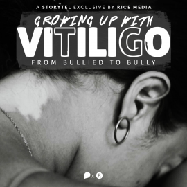 Hörbuch Growing Up With Vitiligo, I Was Bullied—Until I Became A Bully  - Autor RICE media   - gelesen von Vera Chok